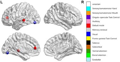 Disrupted Brain Connectivity Networks in Aphasia Revealed by Resting-State fMRI